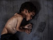 بعد وفاة طفلها جوعًا... أميرة تكافح لإنقاذ أطفالها