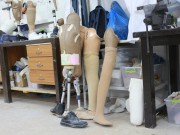 مركز الأطراف بغزة.. حين تنبتُ الأرجل الخشبية في تُربة الصبر