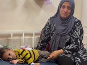 سوء التغذية يهدد حياة الطفل جهاد أبو عكر