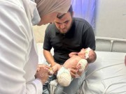 طفولة مبتورة.. الرضيع محمد الخطيب فقد أمه وقدمه