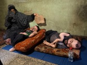 "جسدان من زجاج" يصارعان مرضًا ينهش عظام الصبا