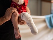 جرحى غزة في الغربة.. النجاة حربٌ أخرى